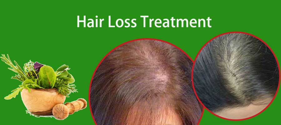 Hair fall 2024 ayurvedic treatment