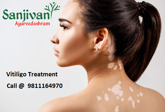 Useful Tips From Experts In Vitiation Treatment - Sanjivani Ayurvedashram